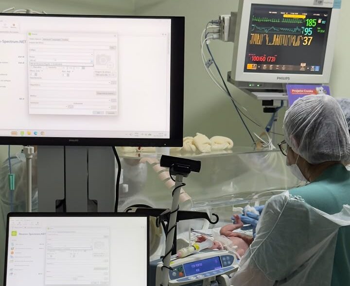 Hospital Jaraguá implanta tecnologia inédita em Santa Catarina para monitoramento cerebral de recém-nascidos
