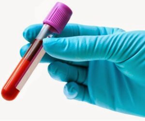 Novo exame de sangue procura sinais de câncer, mas não substitui mamografia nem colonoscopia