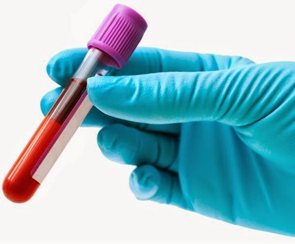 Novo exame de sangue procura sinais de câncer, mas não substitui mamografia nem colonoscopia